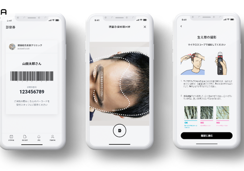 HIX Clinic - App measures hair health