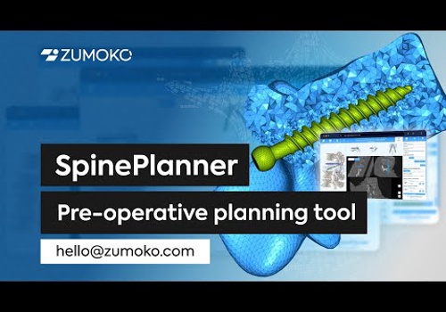 SpinePlanner